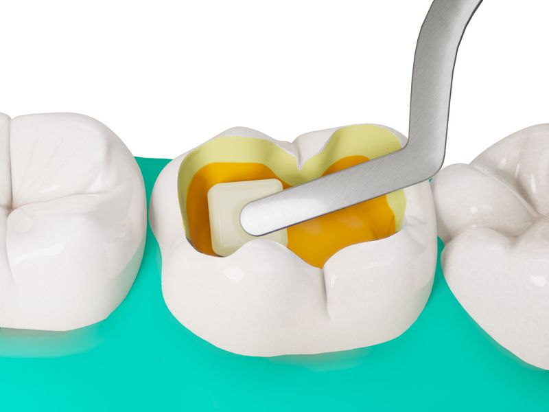 Fibrafill CUBE Aplikace
