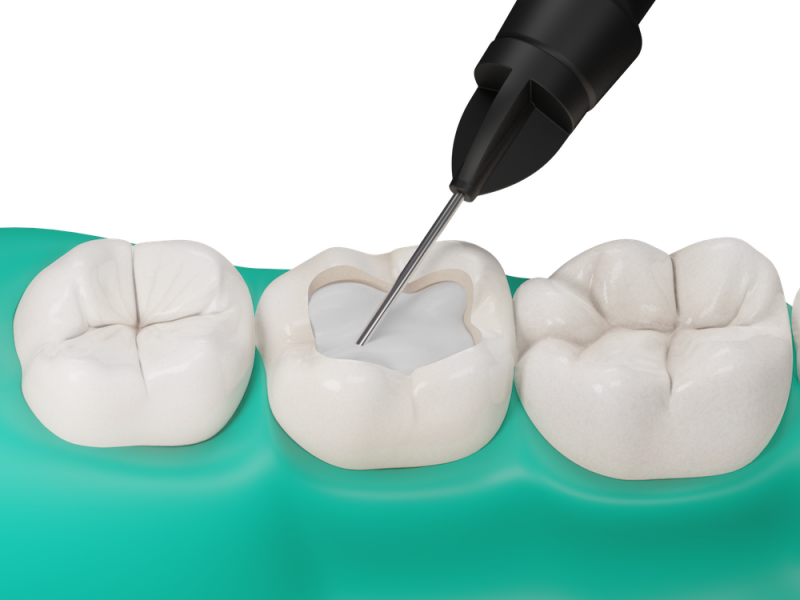 Fibrafill FLOW aplikace